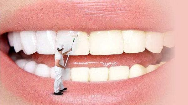 نکاتی در خصوص سفید کردن دندان