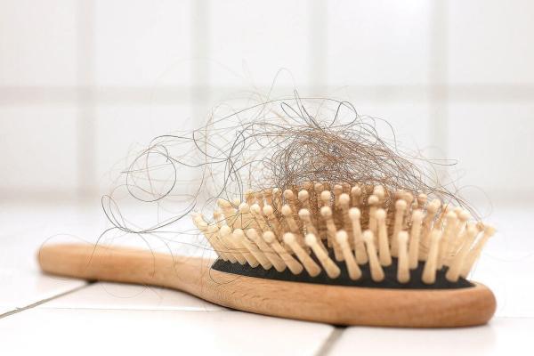 دلیل ریزش شدید و ناگهانی مو ، 5 نشانه در ظاهر موی سر که بیانگر این بیماری هاست